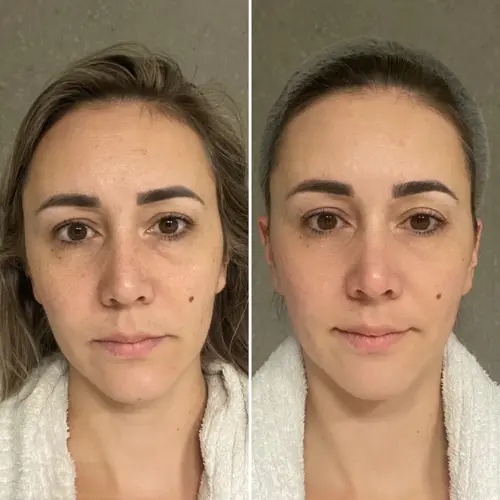 Collagen Tripeptide & Vitamine C - Image 4