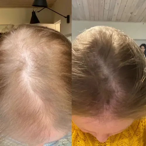 Tripeptide Collagen - Image 5