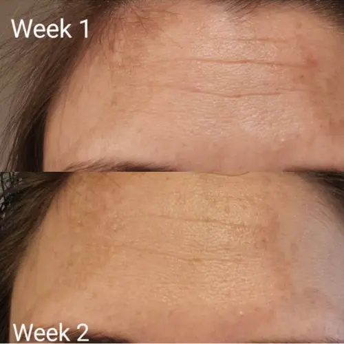 Tripeptide Collagen - Image 6