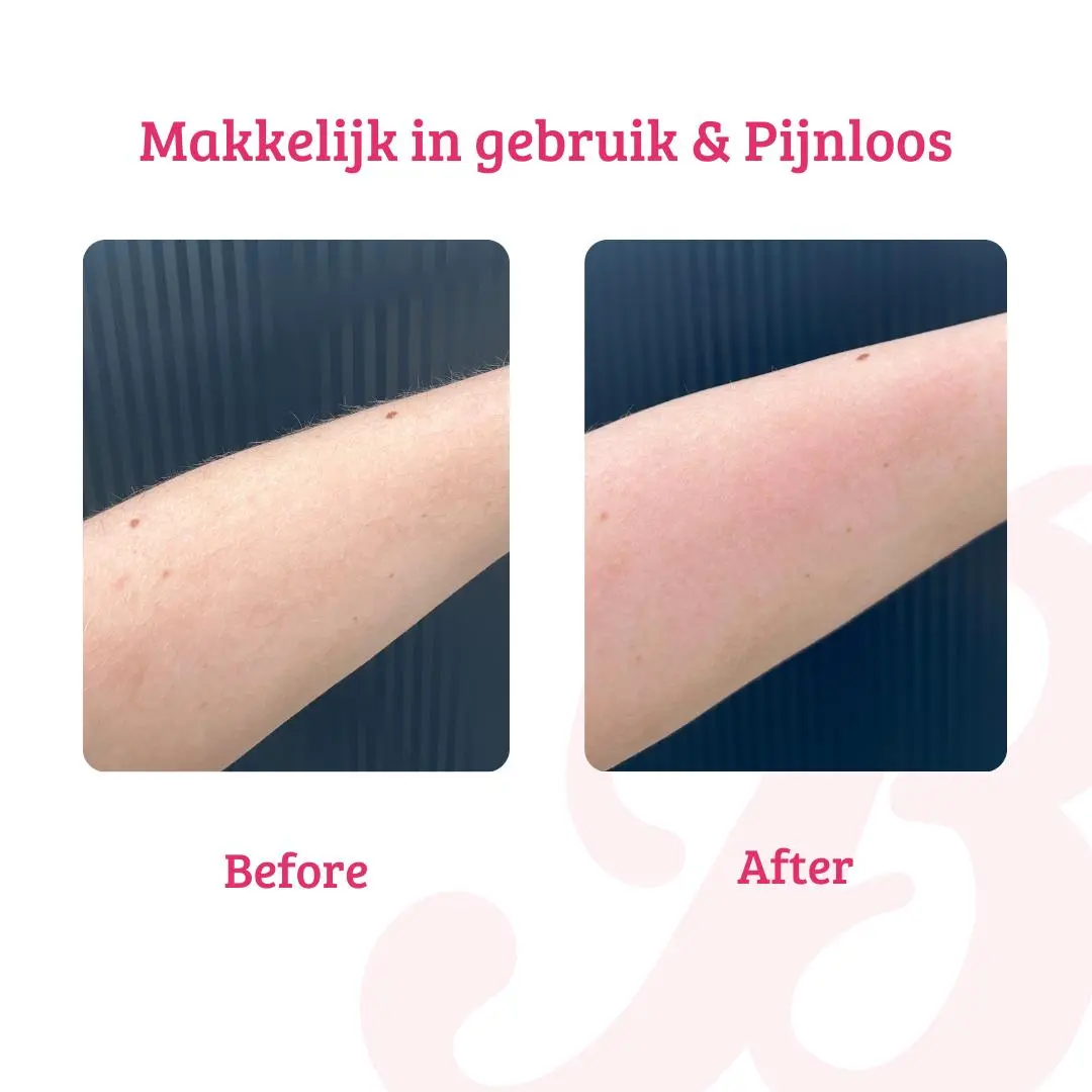 Crystal Hair Eraser - Image 4