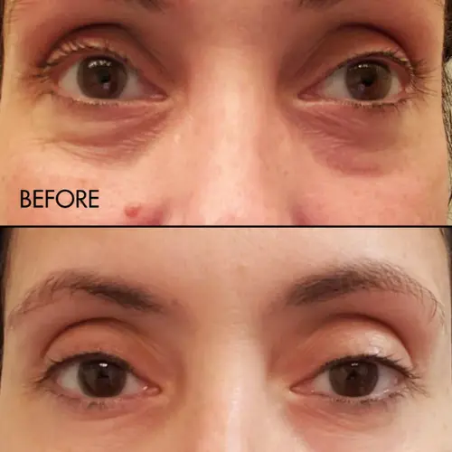 Fermentation Peptine Eye Care Cream - Image 3