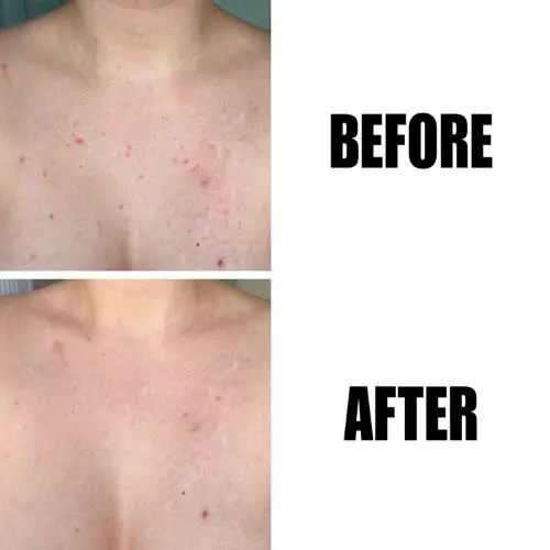 Glycolic Acid Exfoliating Body Stick - Image 4